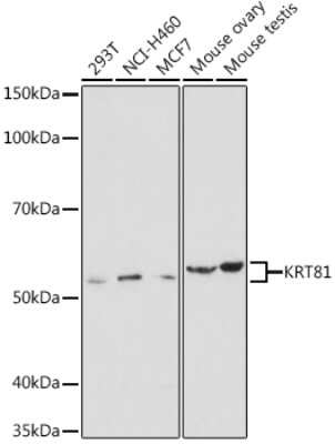Western Blot: KRT81 AntibodyAzide and BSA Free [NBP3-04880]